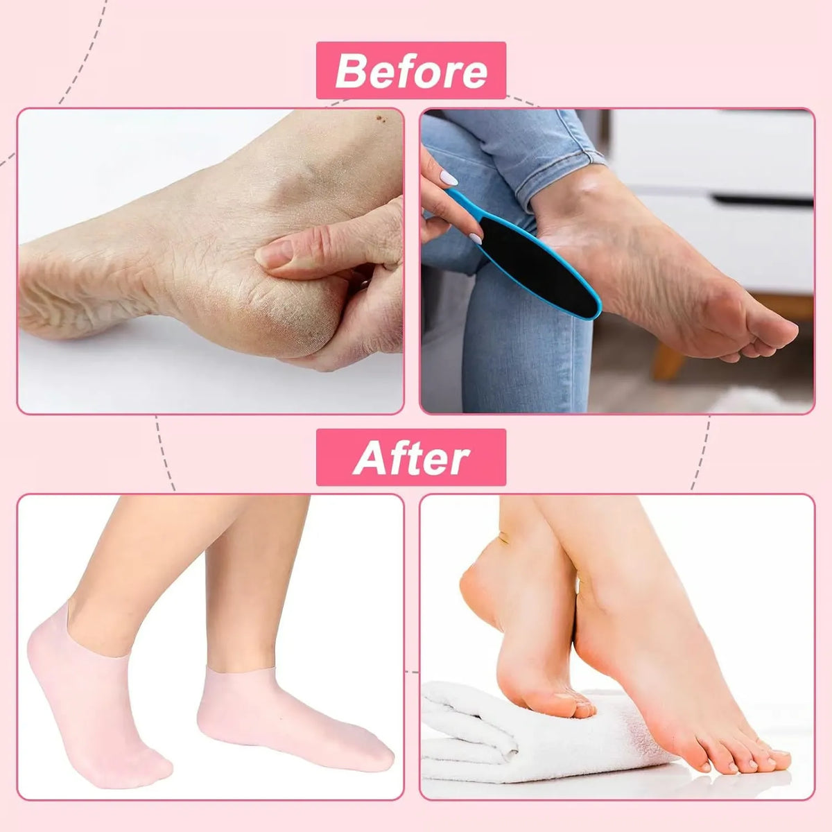 1 Pair Silicone Heel Protectors