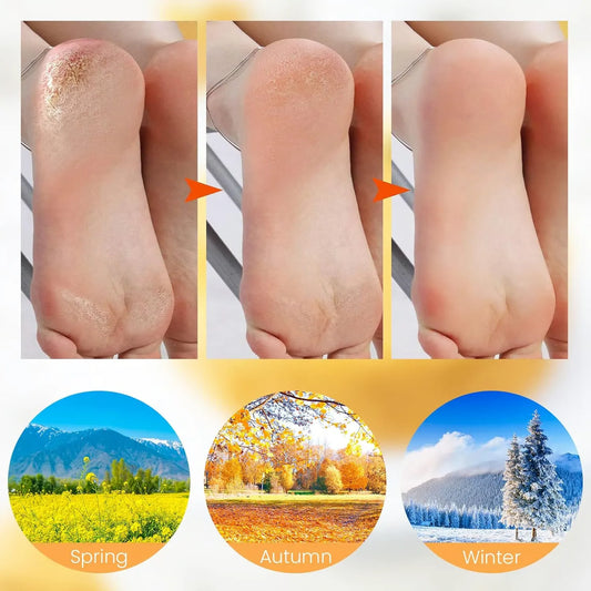 1 Pair Silicone Heel Protectors